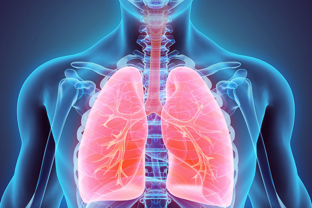 Understanding Non-Small Cell Lung Cancer: Causes, Signs, and Management