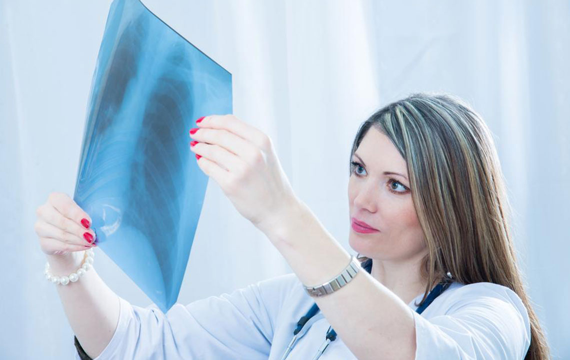 Essential Facts About Pneumococcal Lung Infection