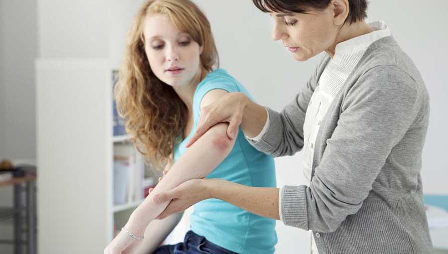 Comprehensive Treatment Strategies for Severe Psoriasis