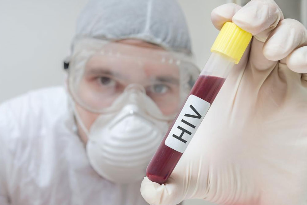 Breakthroughs in HIV Treatment and Prevention Strategies