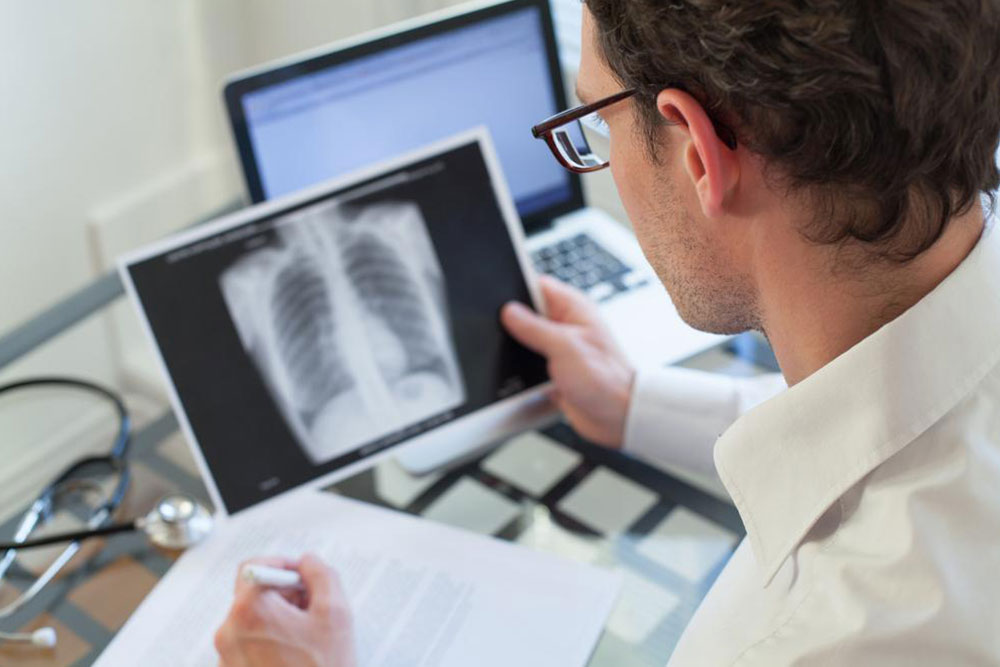 Understanding Recovery After Pulmonary Embolism Treatment