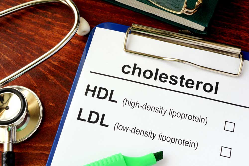 Natural Strategies to Reduce Cholesterol Levels Effectively