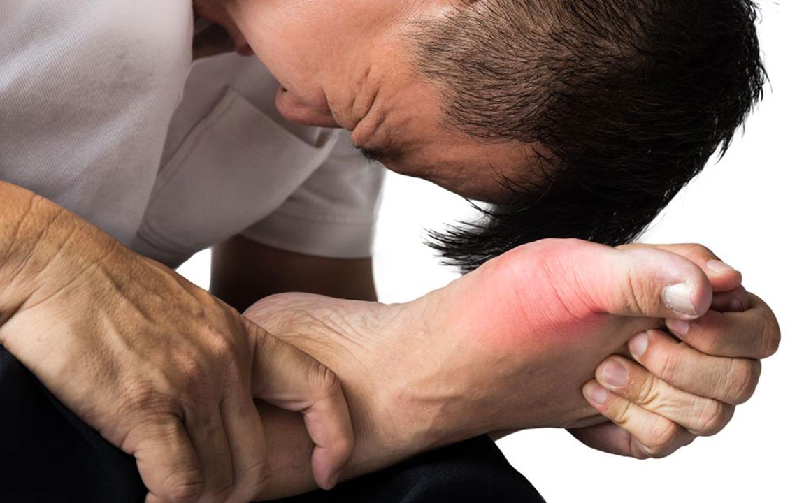 Top Foods to Steer Clear of for Gout Prevention