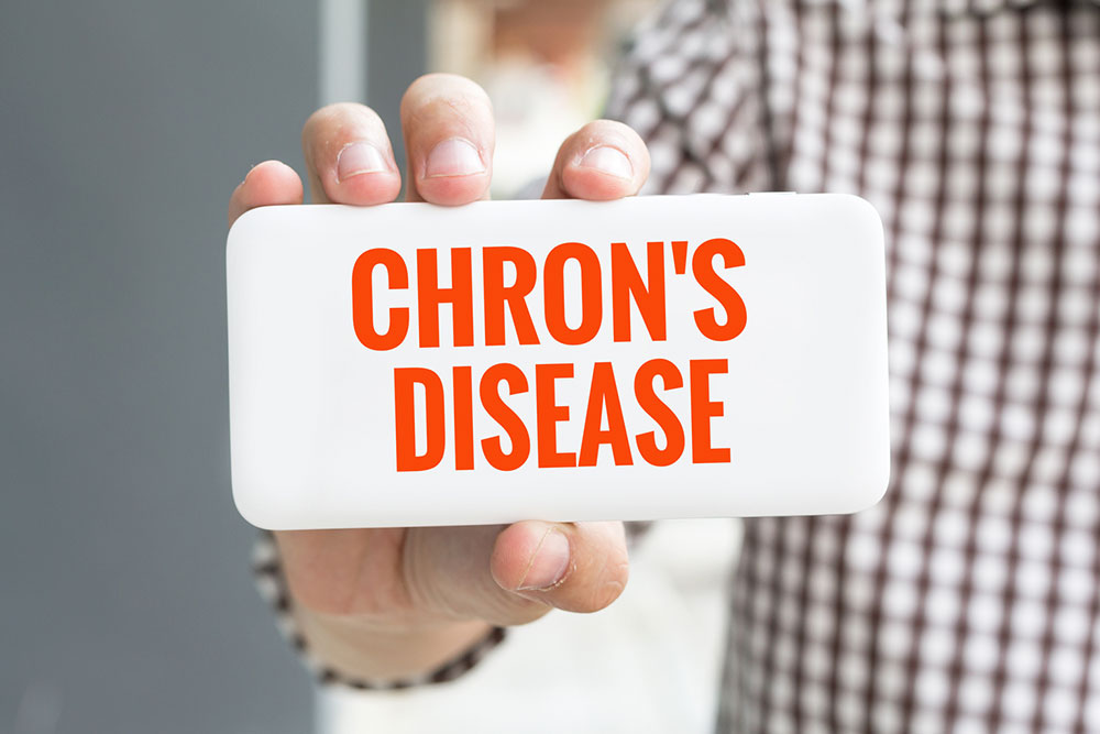 Comprehensive Guide to Managing Crohn's Disease
