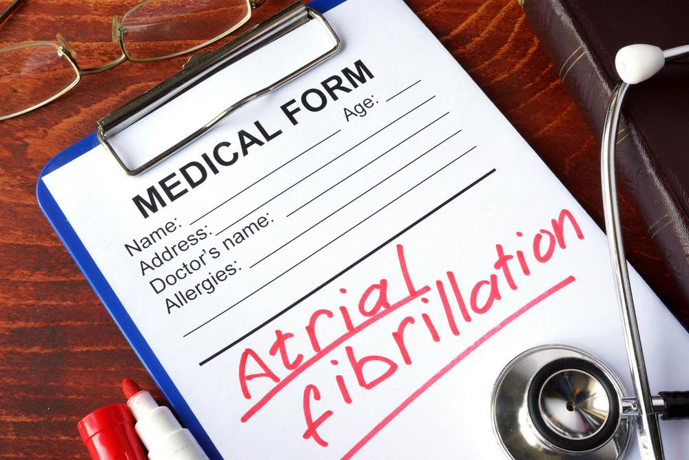 Understanding Atrial Fibrillation: Causes, Symptoms, and Types