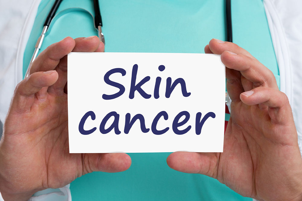 Understanding Skin Cancer: Types, Progression, and Prevention Tips