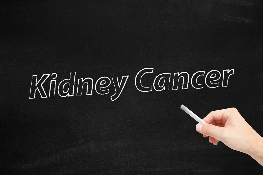 Understanding Kidney Cancer: Symptoms, Stages, and Treatment Options