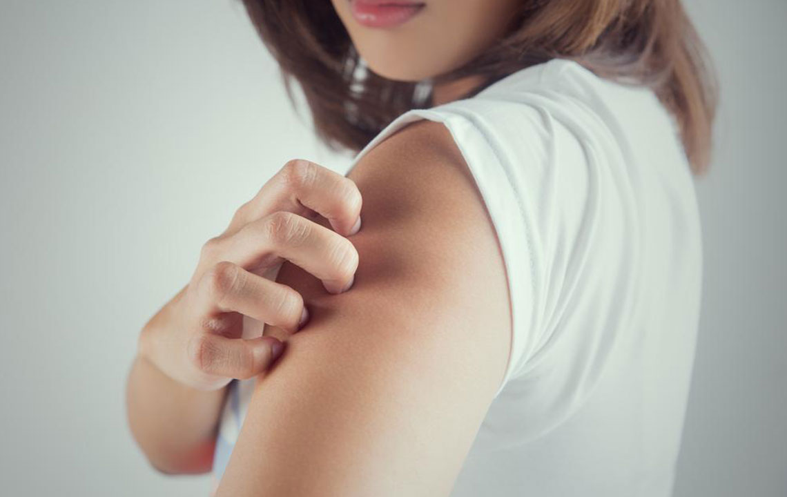 Top 8 Effective Remedies for Dry Skin Relief
