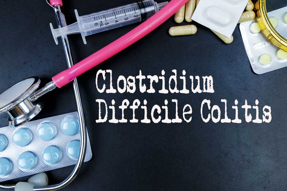 Recognizing Early Signs of C. difficile-Related Colitis