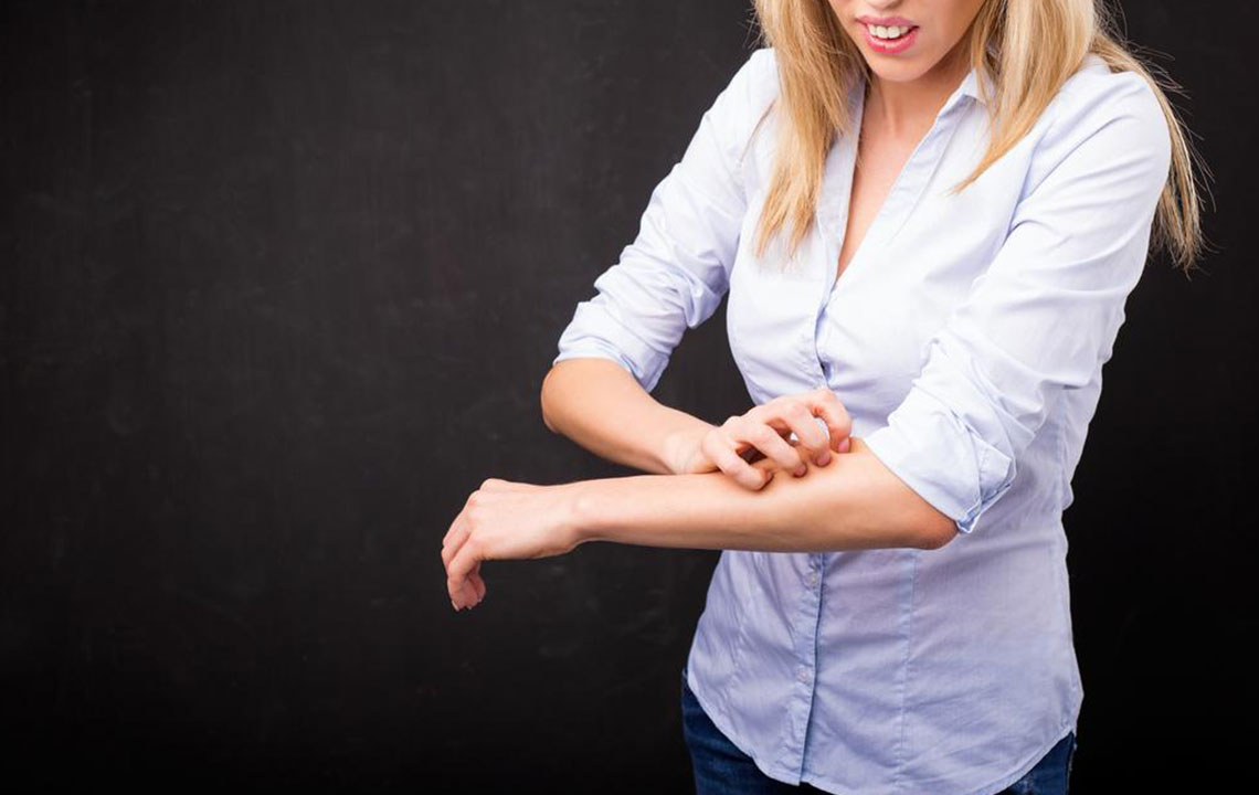 Effective Natural Strategies to Relieve Eczema Symptoms at Home