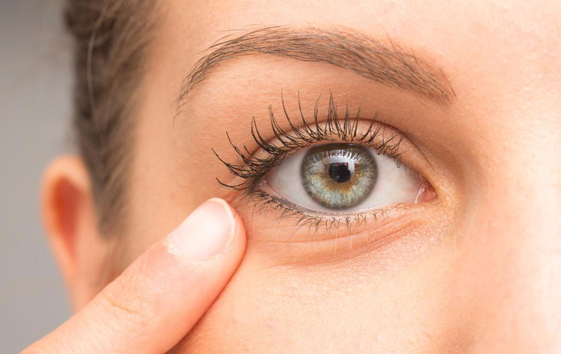 Effective Strategies to Reduce Under-Eye Puffiness