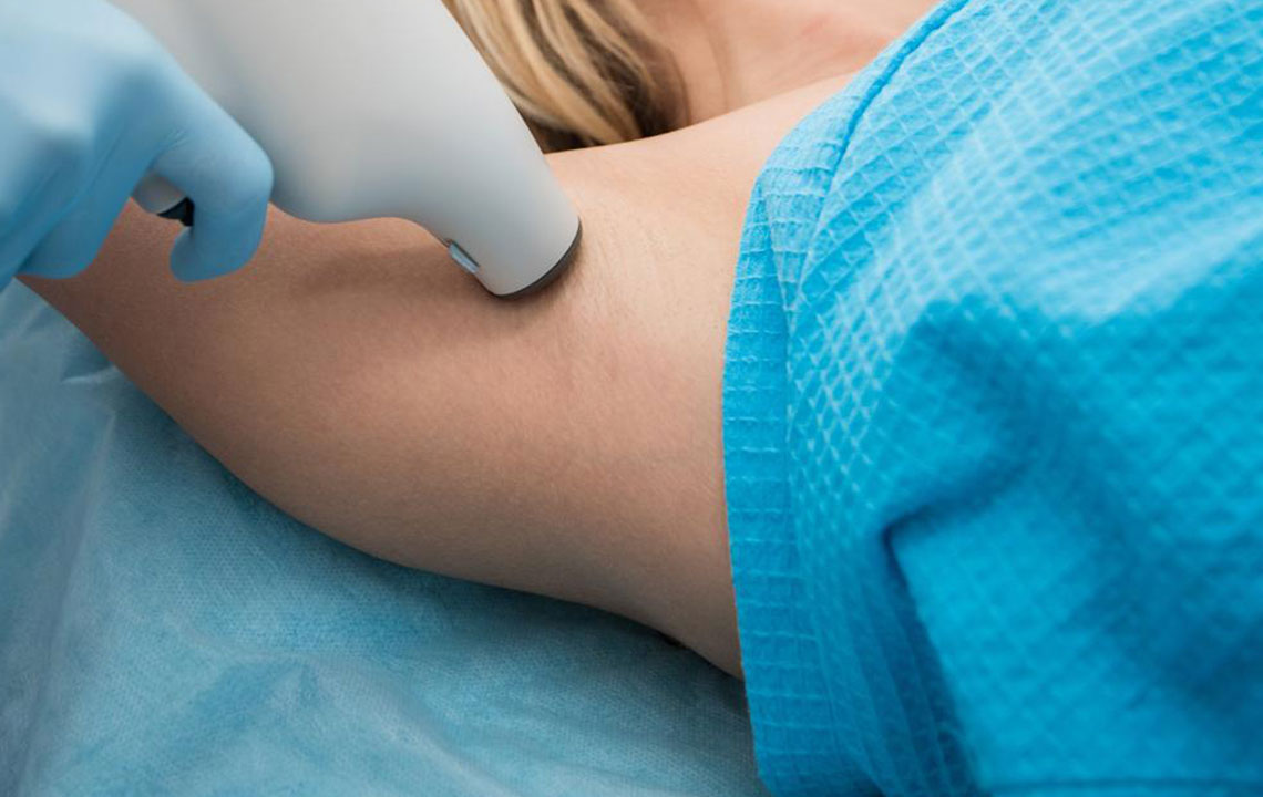 Effective Treatments for Excessive Sweating (Hyperhidrosis)