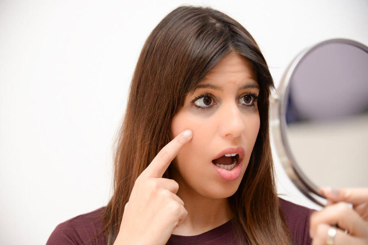 Effective Treatments for Dark Circles You Might Not Be Aware Of