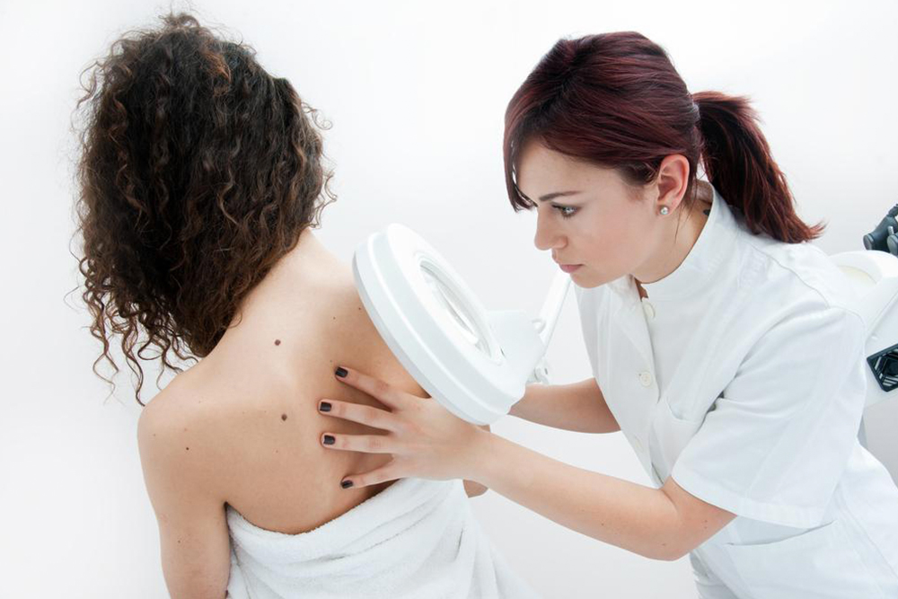Understanding Advanced Melanoma: Symptoms and Treatment Options