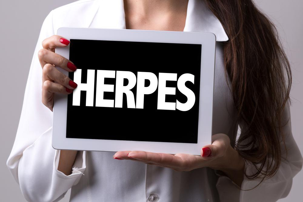 Natural and Emerging Alternatives for Managing Herpes