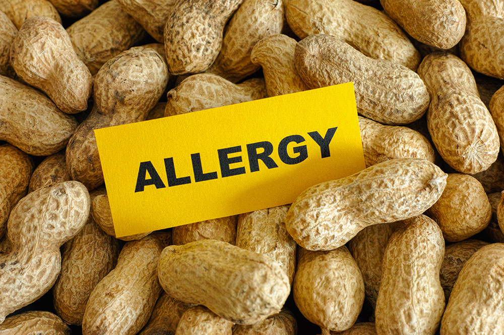 Top 5 Food Allergies and How to Manage Them