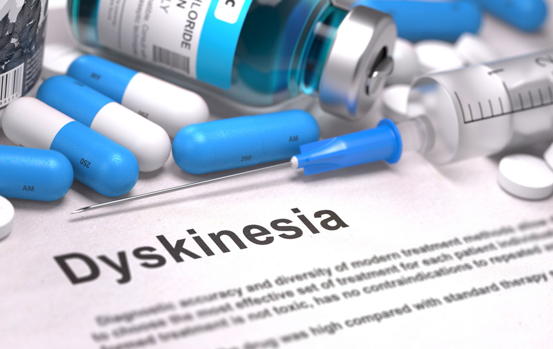 Comprehensive Guide to Tardive Dyskinesia: Causes, Diagnosis, and Effective Management Strategies