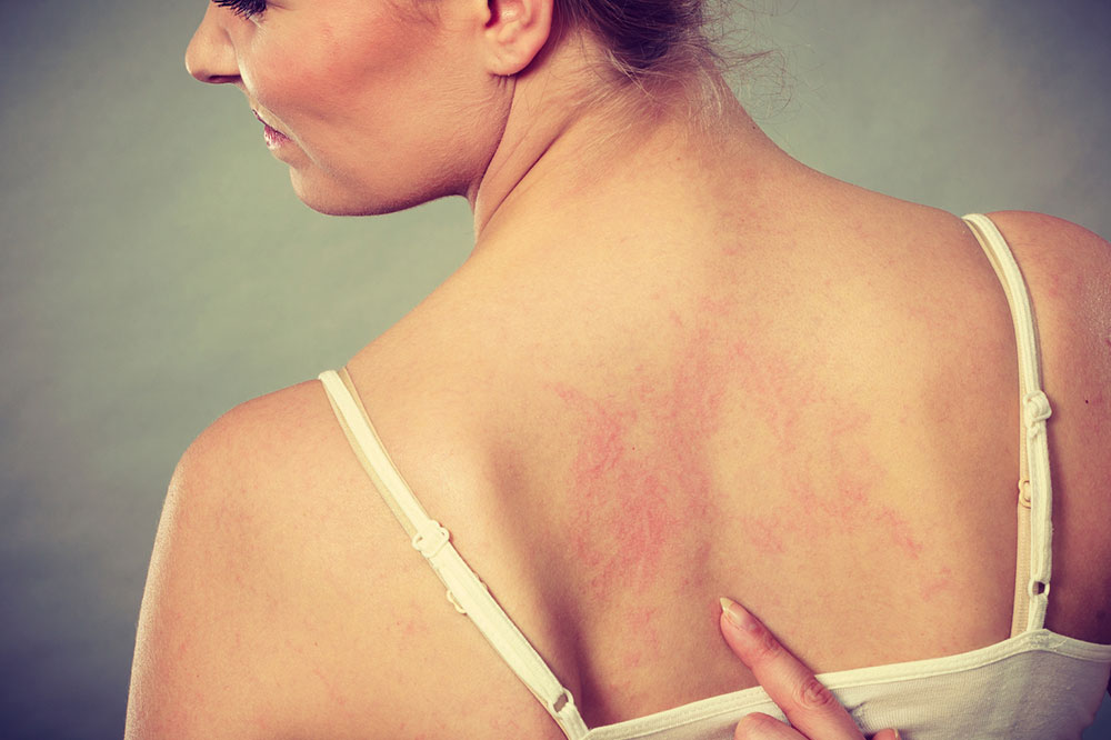 Comprehensive Guide to Skin Conditions and Their Underlying Causes