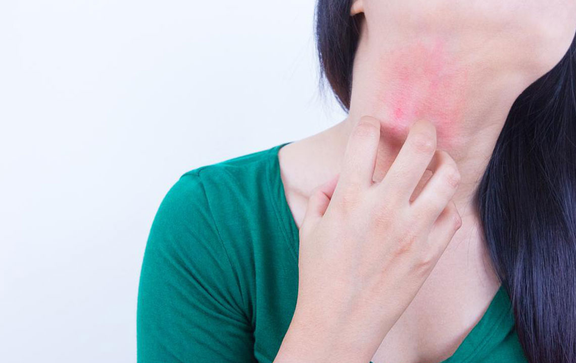 Understanding and Managing Postherpetic Neuralgia