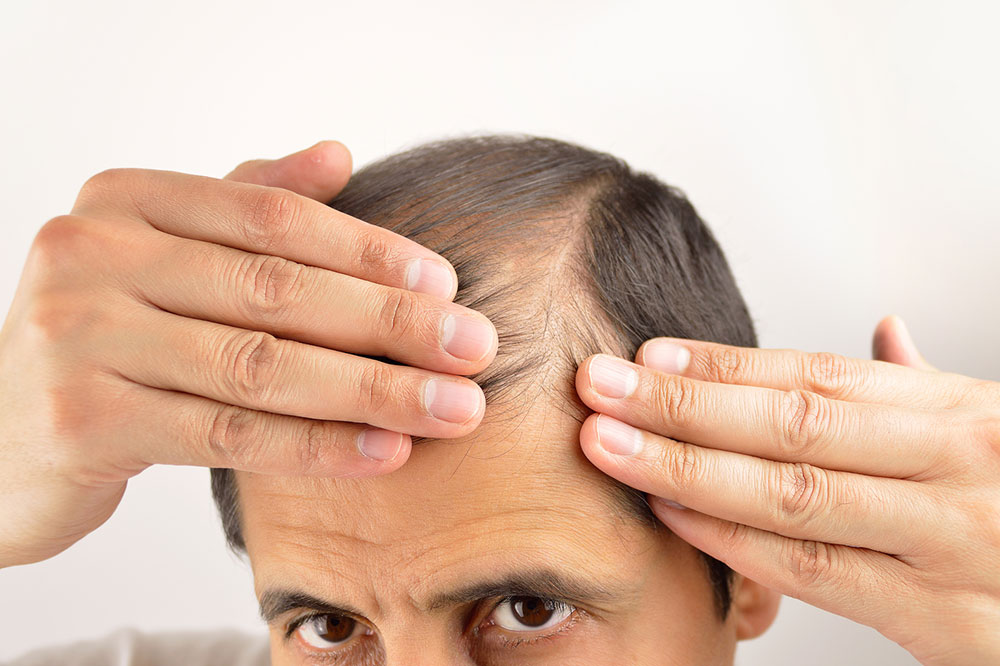 Understanding the Four Main Causes of Unusual Hair Thinning and How to Address Them