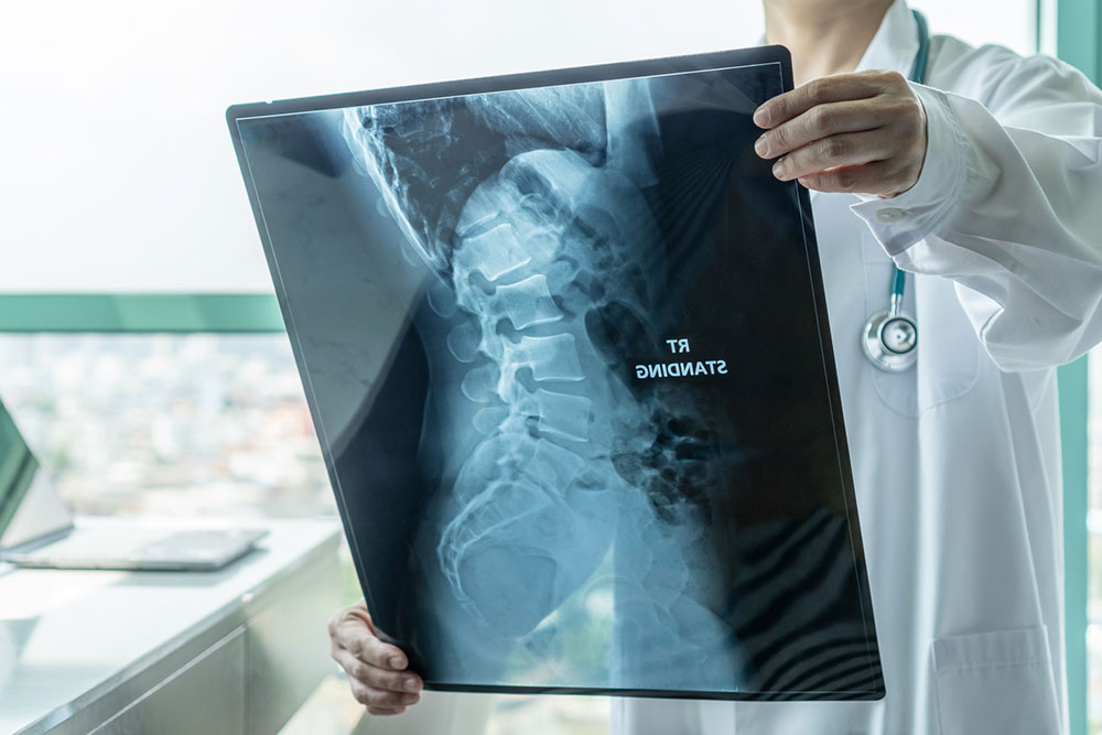 Comprehensive Guide to Recognizing the 8 Major Signs of Cervical Degeneration