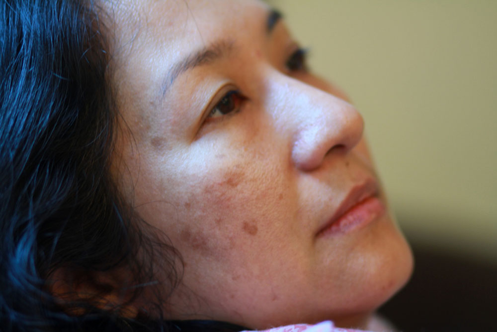 Top 10 Skin Issues and Effective Remedies