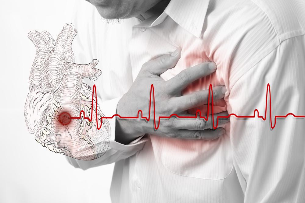 Understanding Atrial Fibrillation: Symptoms and Treatment Options