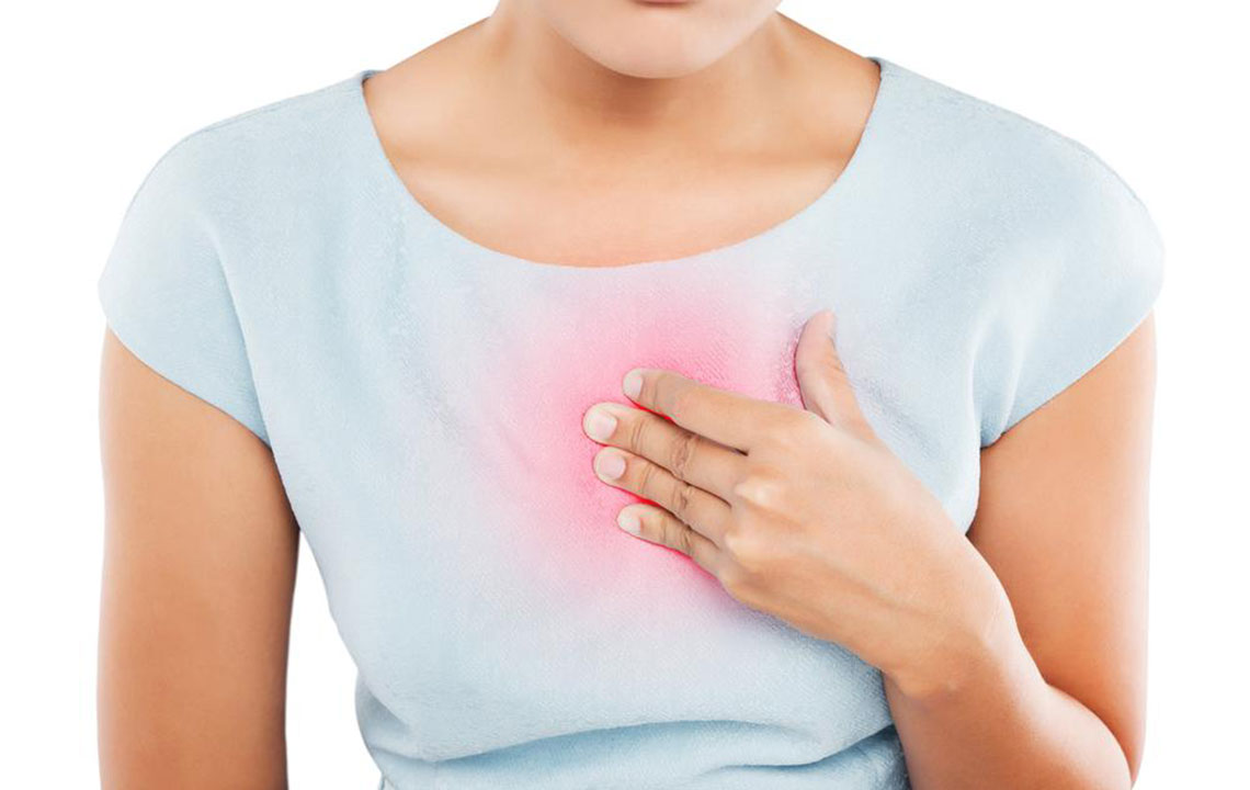 Essential Insights on Managing Heartburn Effectively