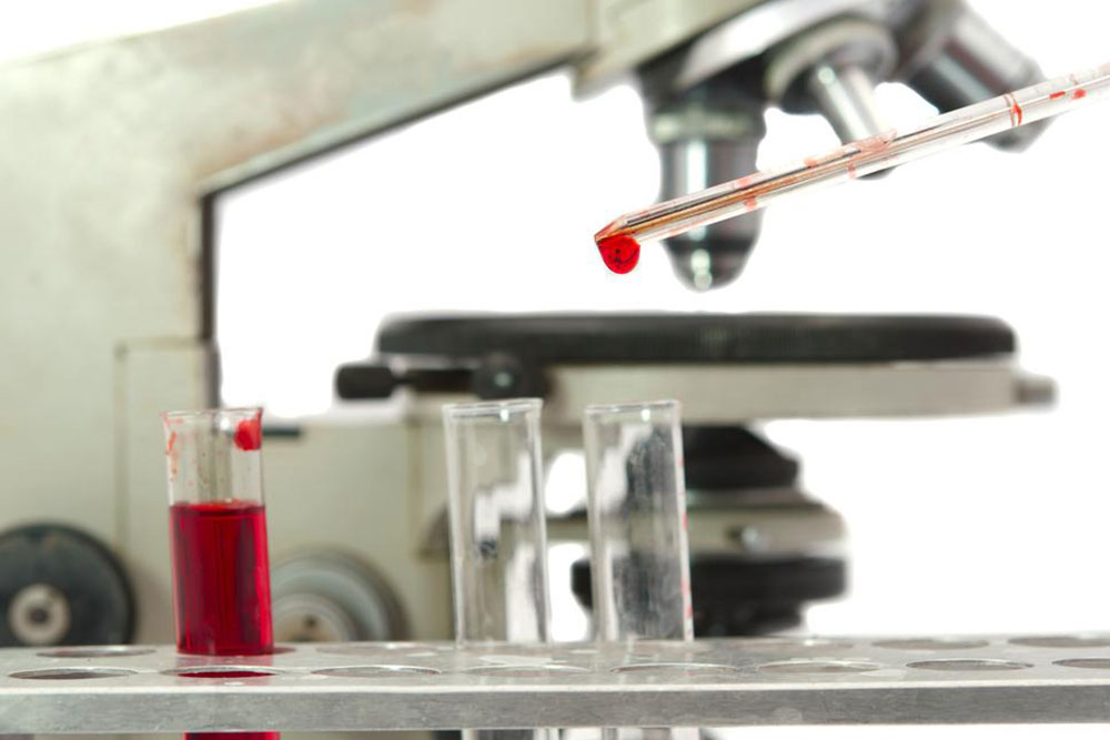 Understanding White Blood Cell Count and Its Significance