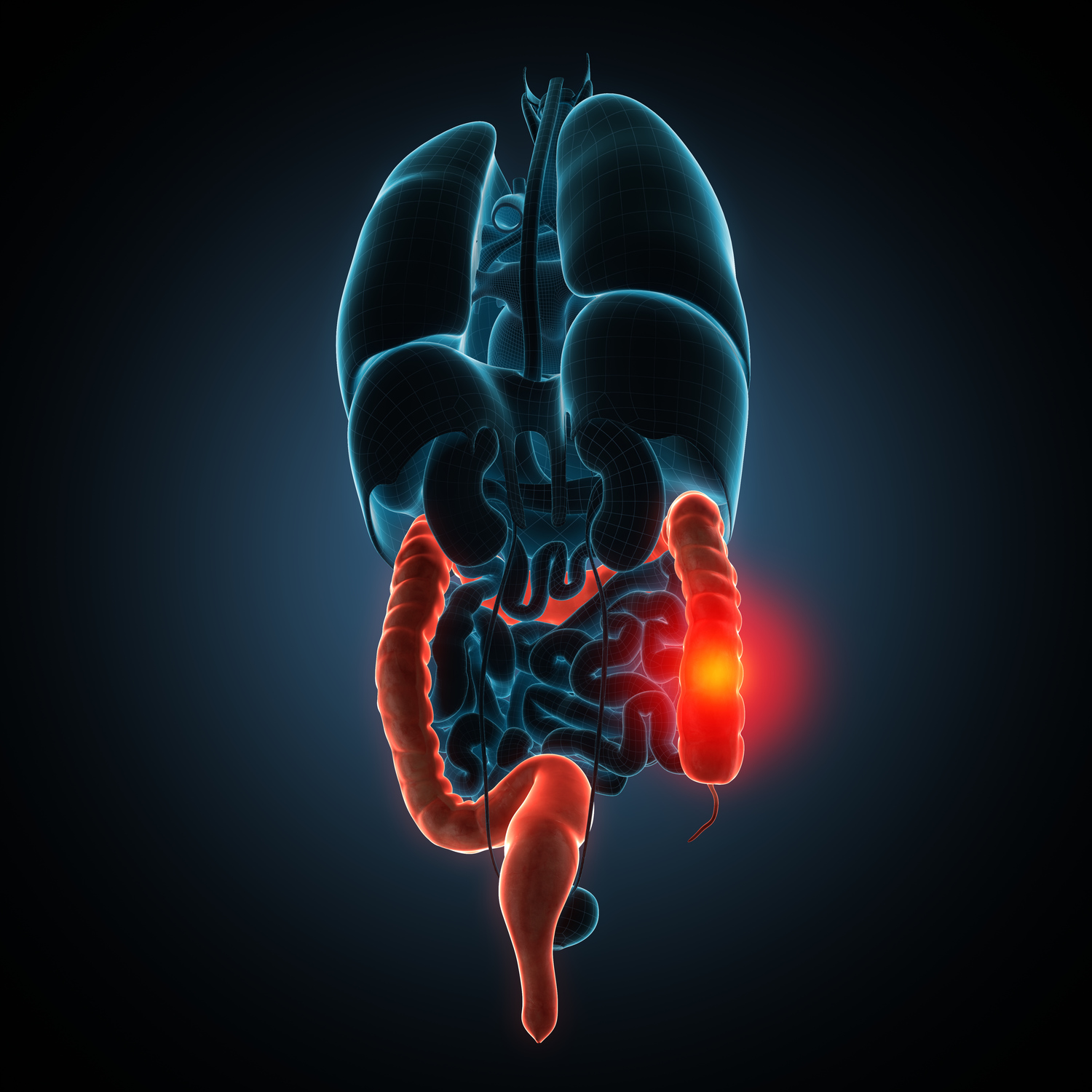 Recognizing the Key Symptoms and Risks of Crohn’s Disease