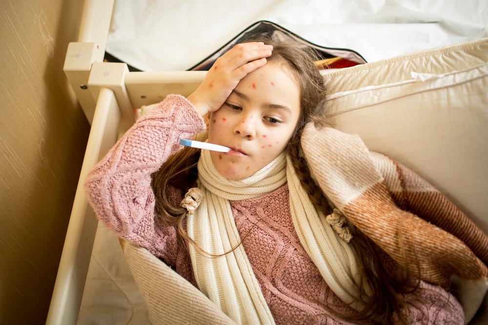 Essential Insights on Measles and Its Prevention