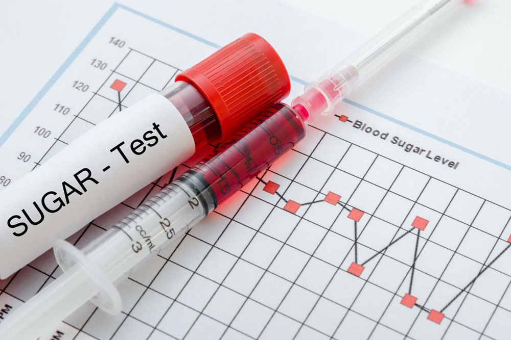 Understanding Blood Sugar Levels: Essential Facts and Management Tips
