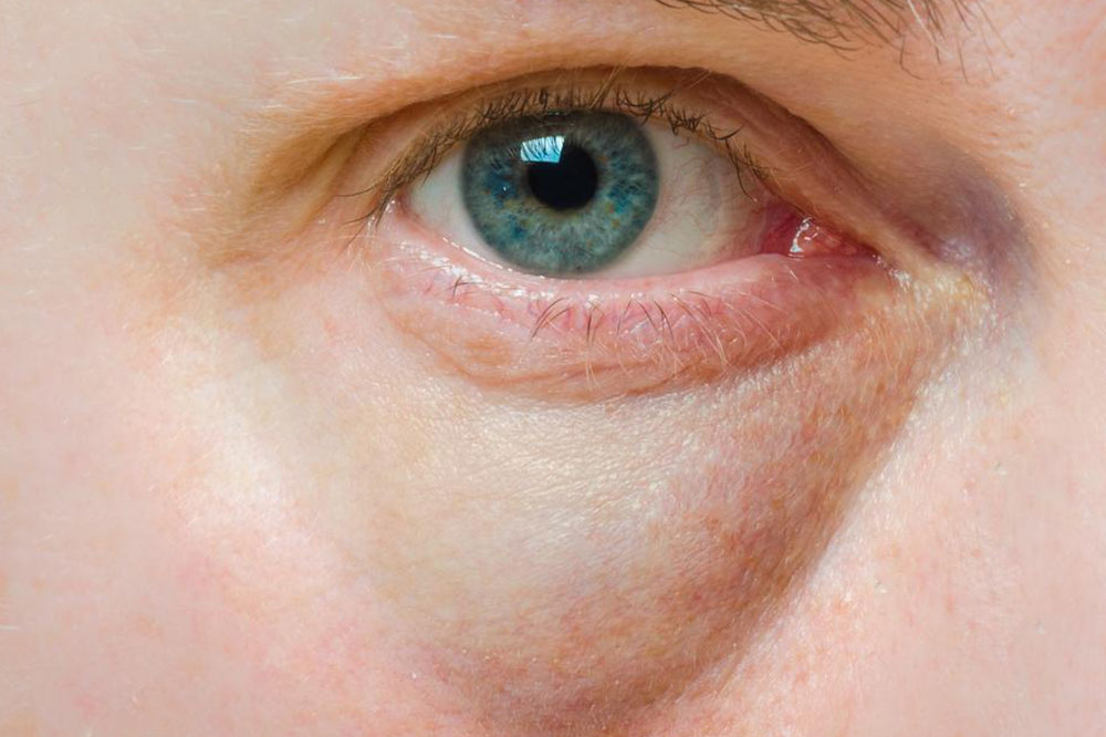Comprehensive Eye Health & Treatment Strategies