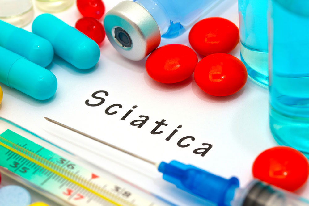 Effective Strategies for Managing Sciatic Nerve Pain
