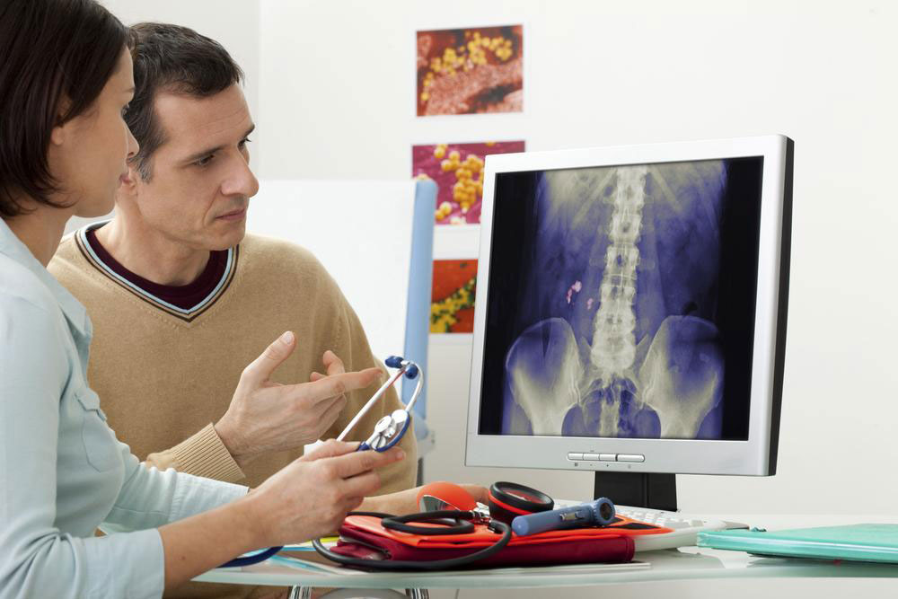 Top 5 Frequently Asked Questions About Kidney Stones