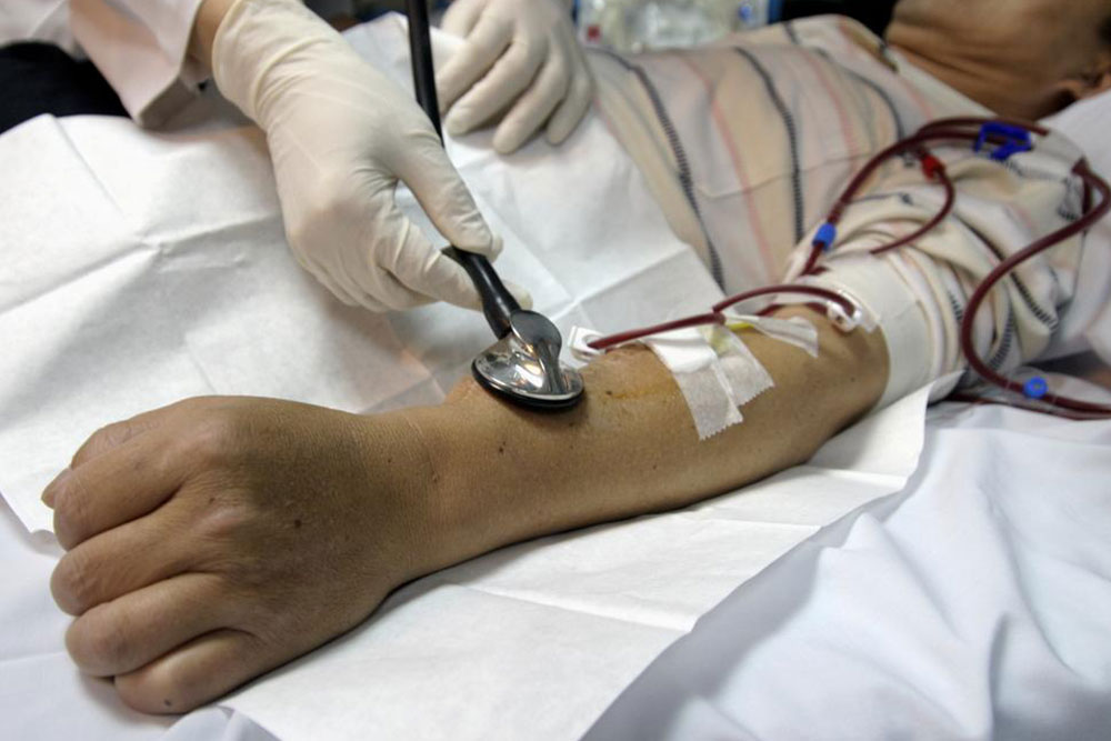 Essential Insights for Individuals Undergoing Kidney Hemodialysis