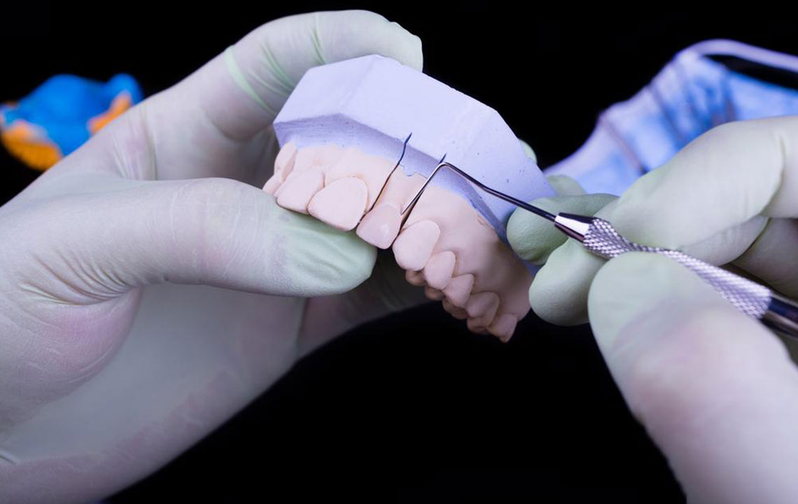 Effective Strategies to Reduce Your Denture Costs and Save Money