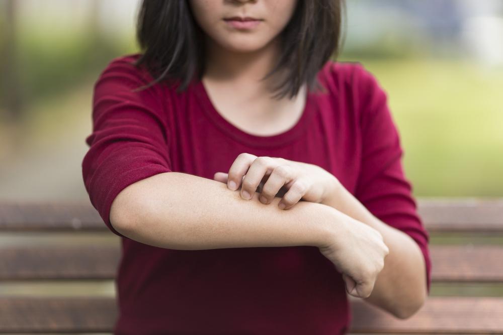 Understanding Causes and Remedies for Itchy Skin