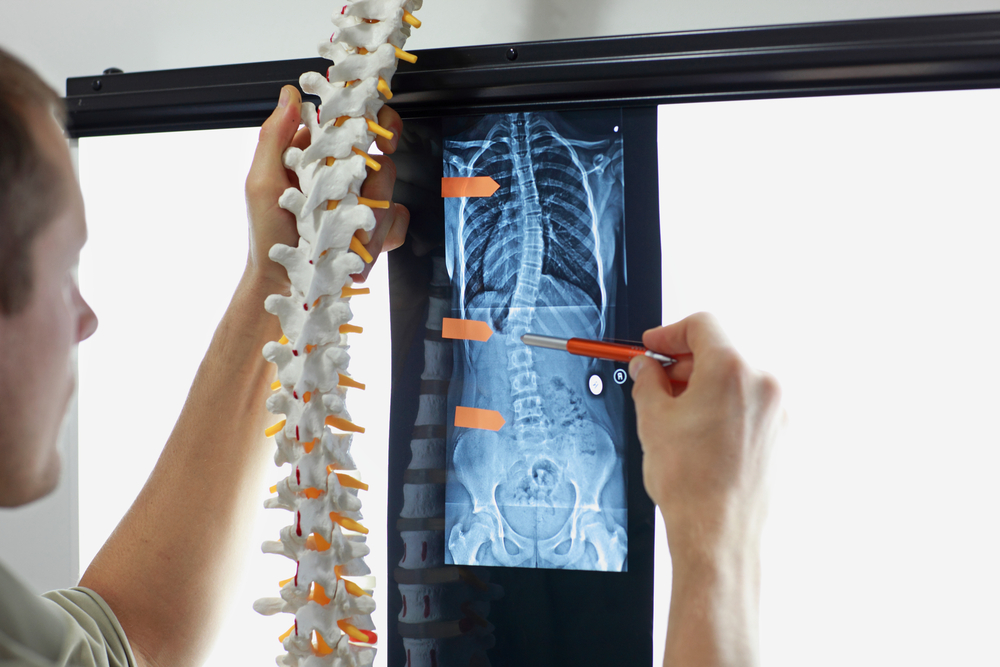 Understanding Herniated Disc: Symptoms, Causes, and Treatment Strategies