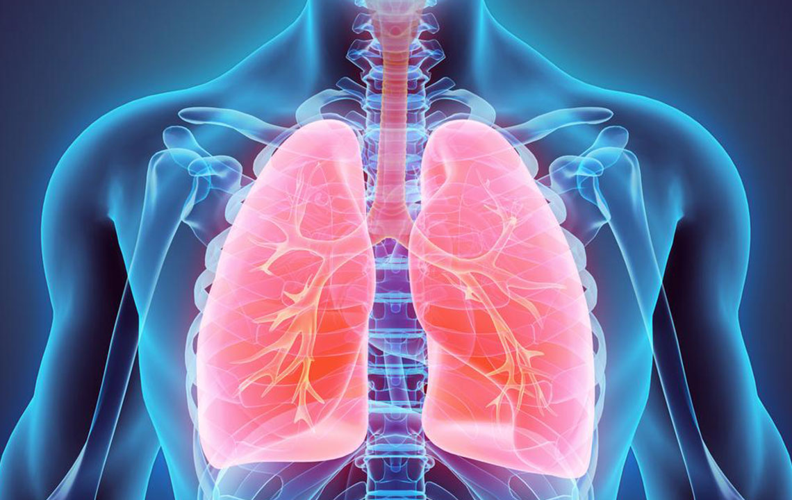 Essential Insights into Lung Cancer Symptoms and Management Strategies