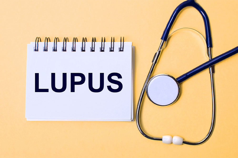 A Comprehensive Guide to Lupus: Recognizing Symptoms, Causes, and Different Types