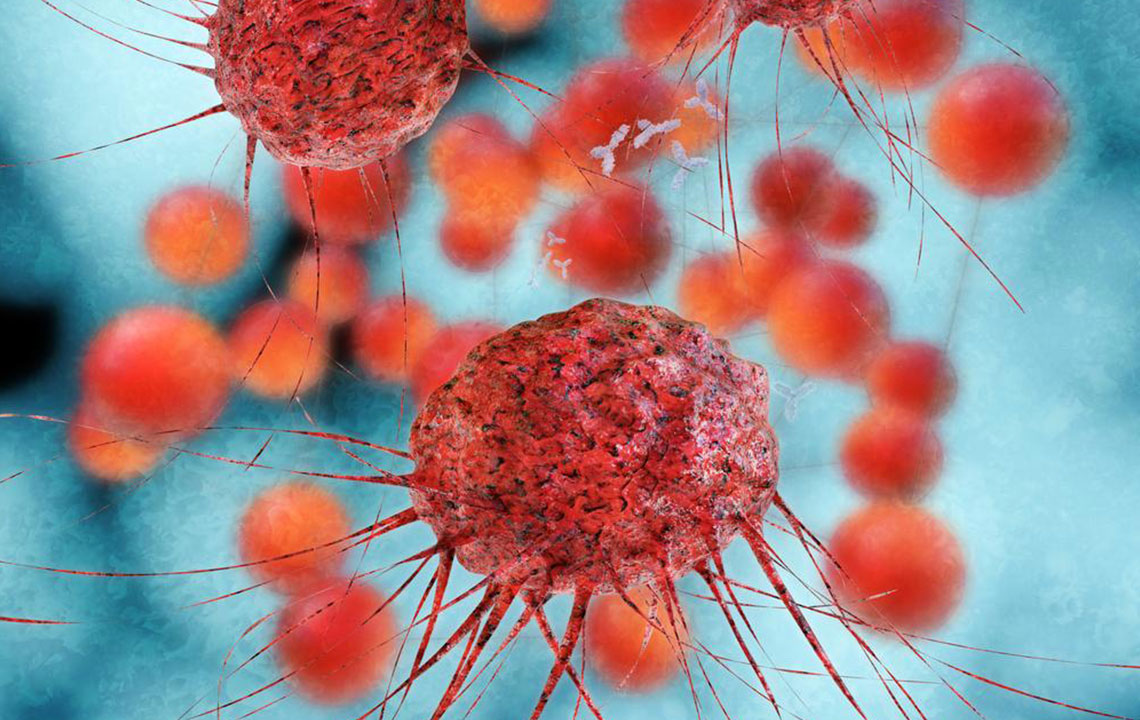 A Comprehensive Guide to Advanced Ovarian Cancer Treatment Options