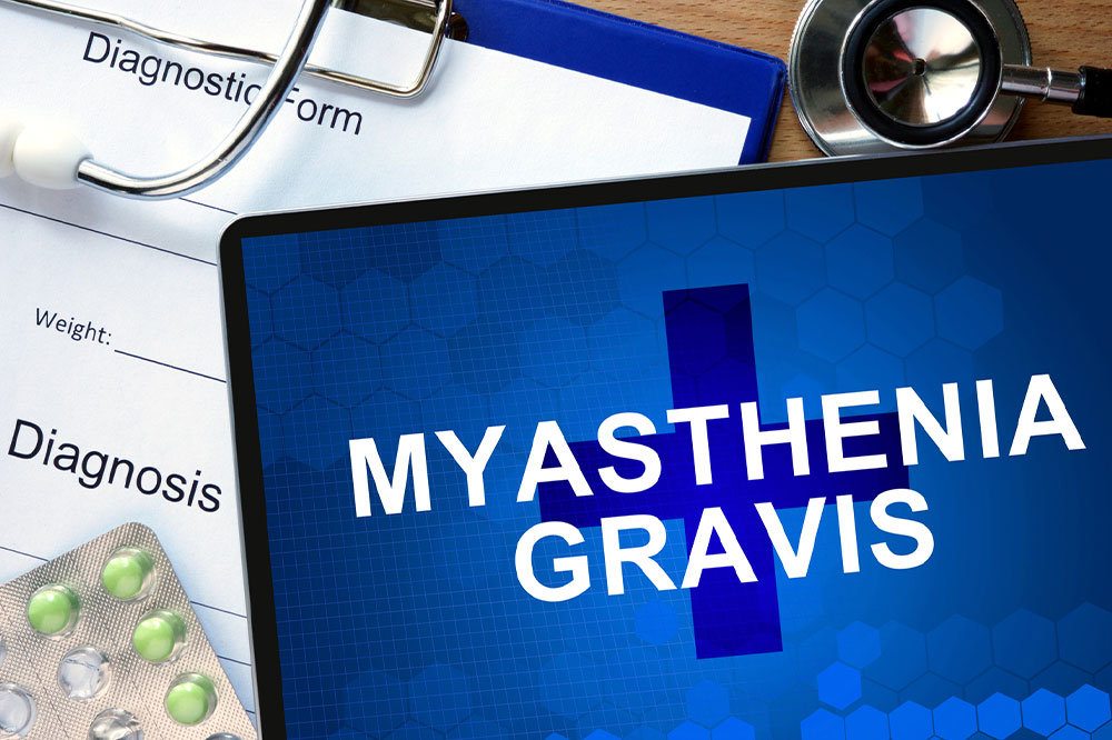 Effective Management Strategies for Myasthenia Gravis Patients