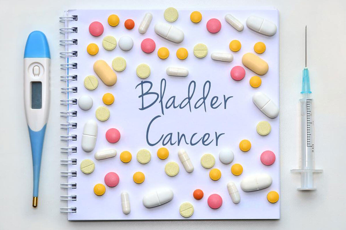 Signs and Symptoms of Bladder Cancer You Should Know