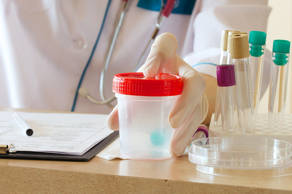 Understanding Cloudy Urine: Causes, Symptoms, and Natural Remedies