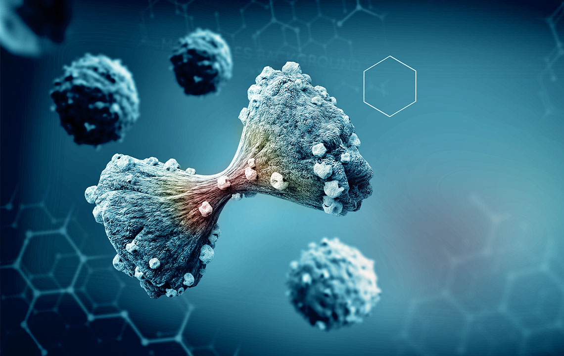 Signs and Symptoms of Multiple Myeloma You Should Recognize