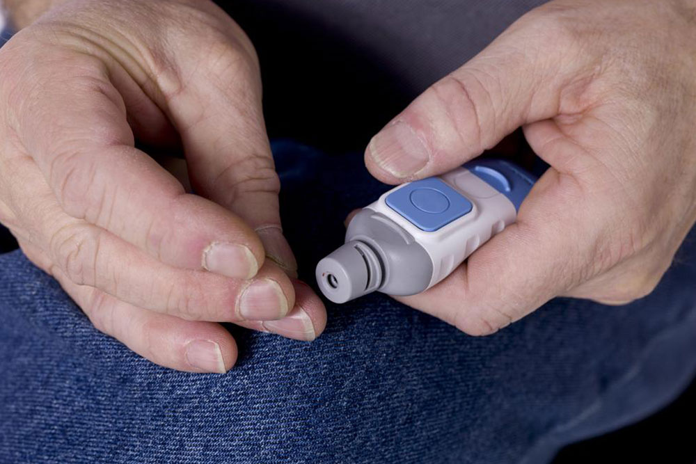 Comprehensive Guide to Blood Glucose Testing and Its Significance