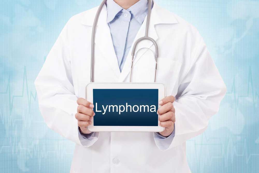 Comprehensive Guide to the Various Types of Lymphoma
