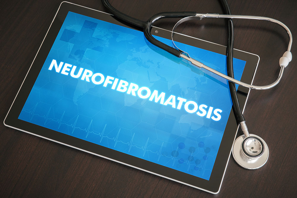 Comprehensive Medical Approaches for Neurofibromatosis Management