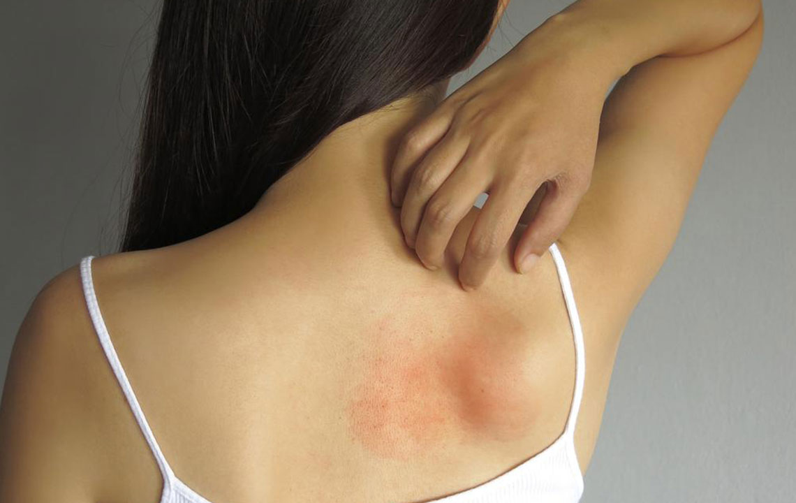 Effective Strategies for Managing Mold-Related Health Issues